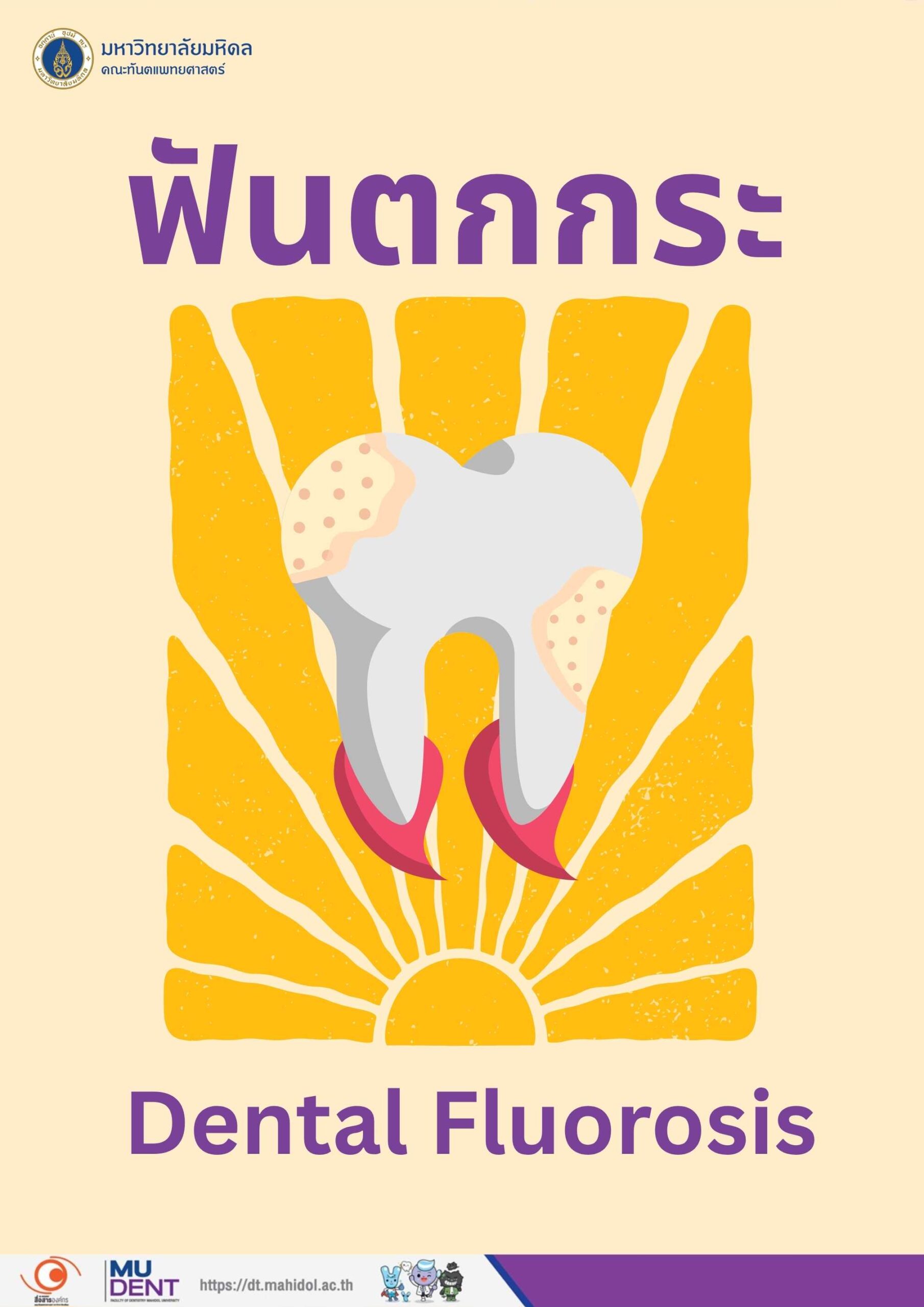 ฟันตกกระ (Dental Fluorosis)