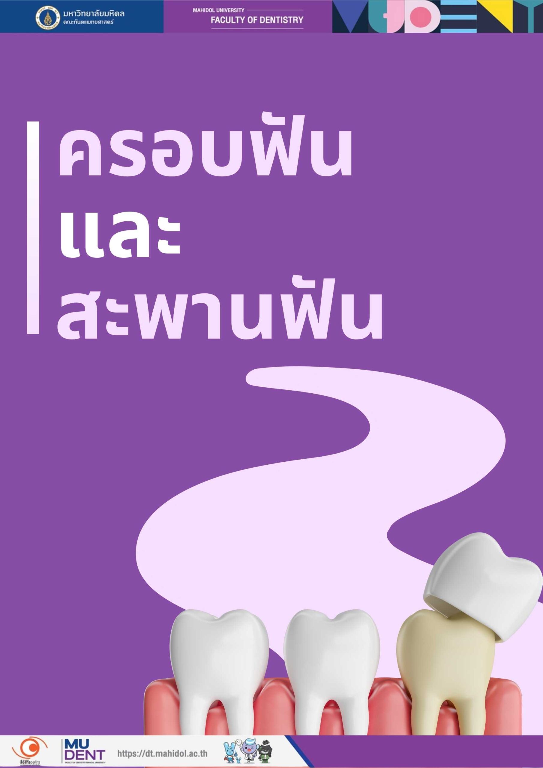 ครอบฟันและสะพานฟัน