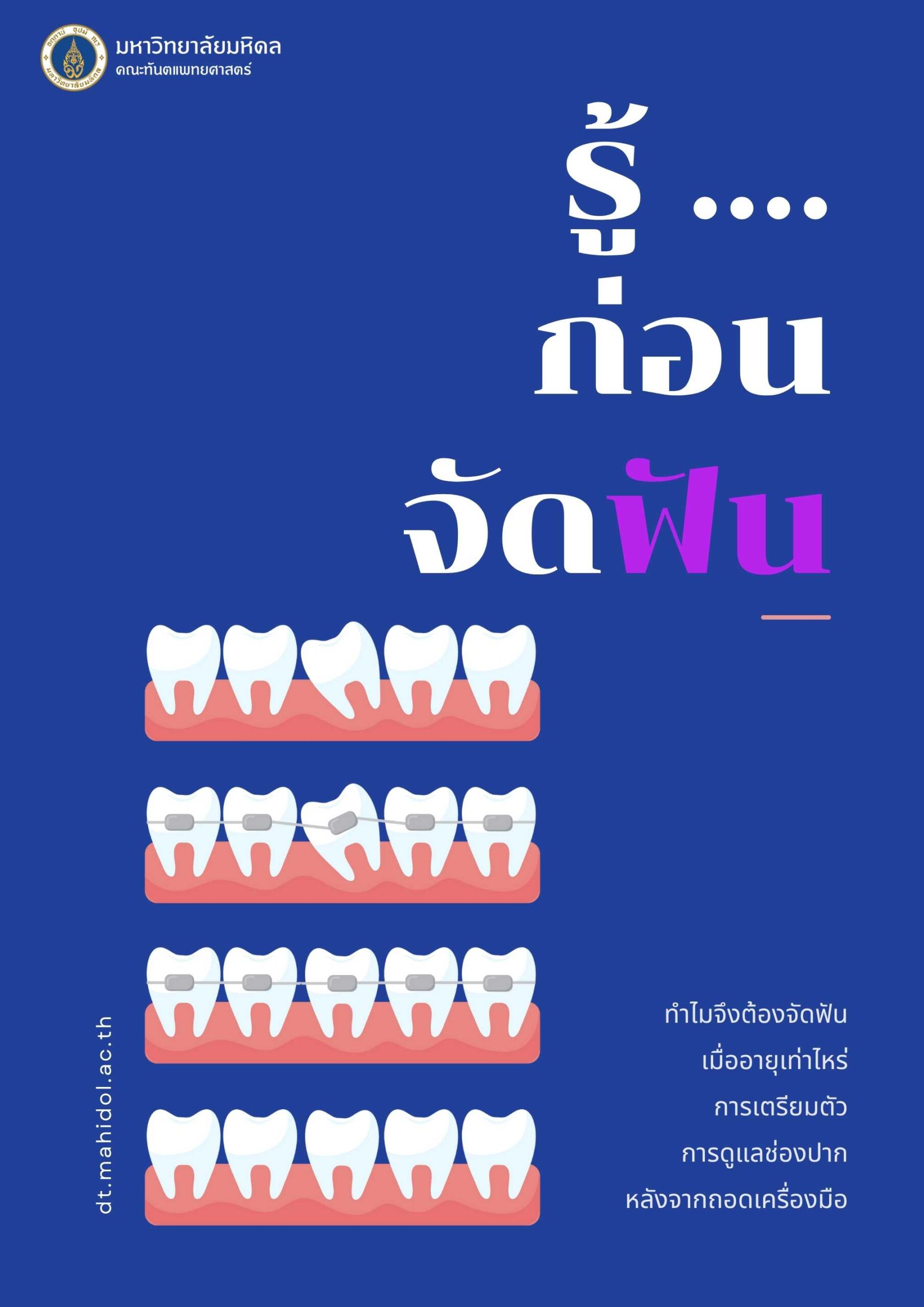 รู้ …. ก่อนจัดฟัน