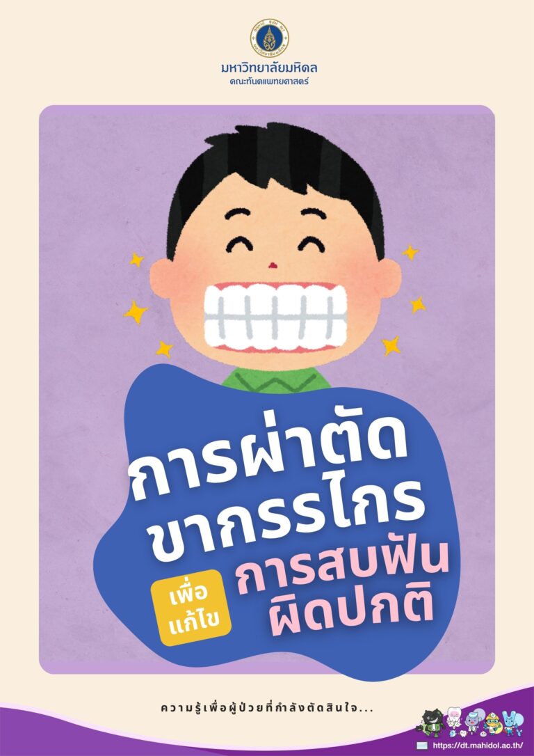 การผ่าตัดขากรรไกรเพื่อแก้ไขการสบฟันผิดปกติ : ความรู้เพื่อผู้ป่วยที่กำลังตัดสินใจ