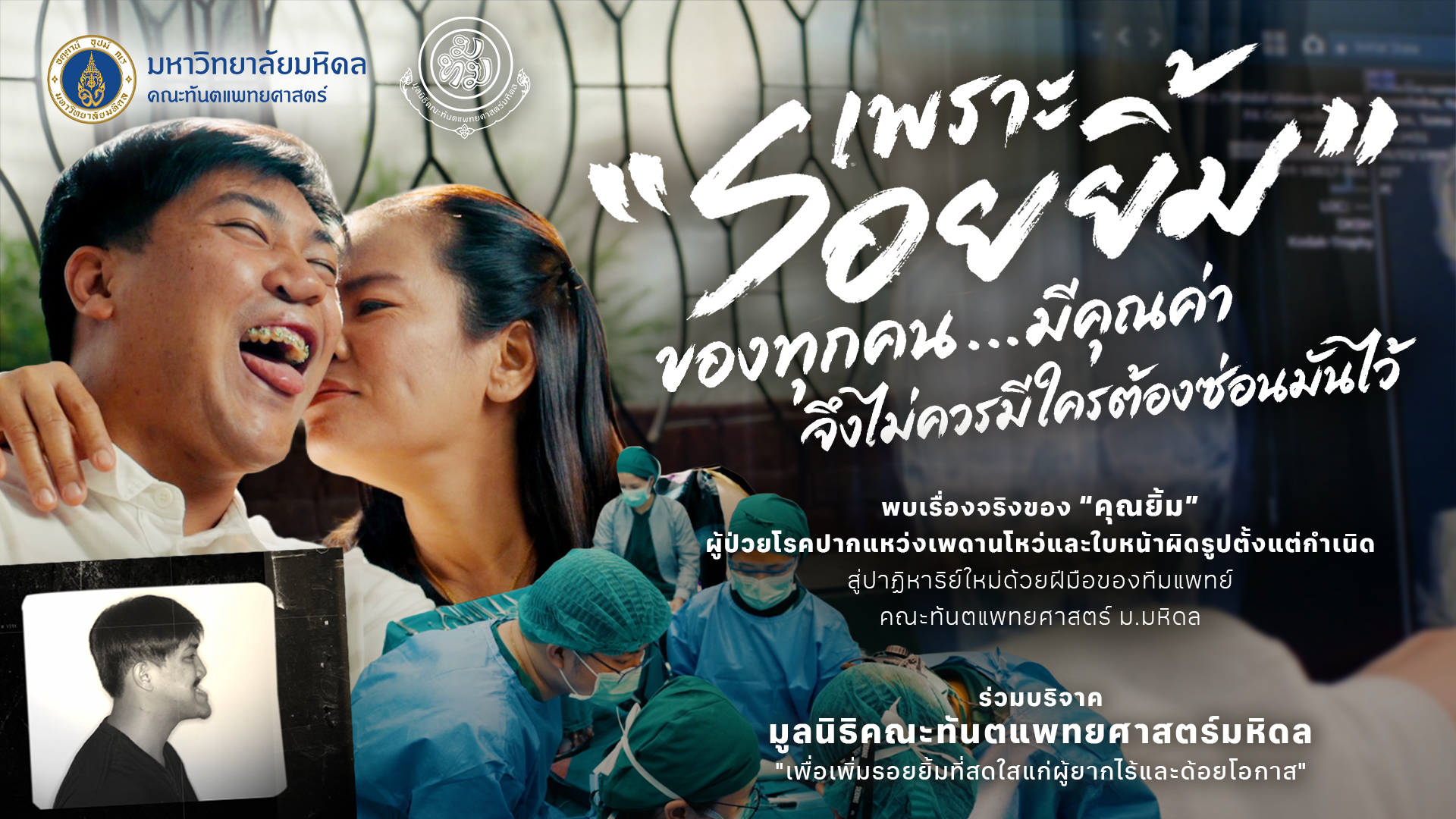 เบื้องหลังรอยยิ้มของ “คุณบุญโชค” ผู้ป่วยปากแหว่งที่ได้รับการผ่าตัดฟื้นฟูใบหน้า โดยทีมทันตแพทย์จากคณะทันตแพทยศาสตร์ มหาวิทยาลัยมหิดล