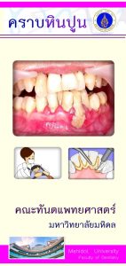 brochure-dentist-15-1