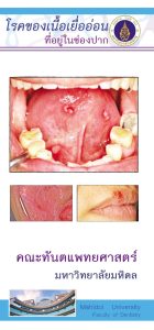 brochure-dentist-8-1